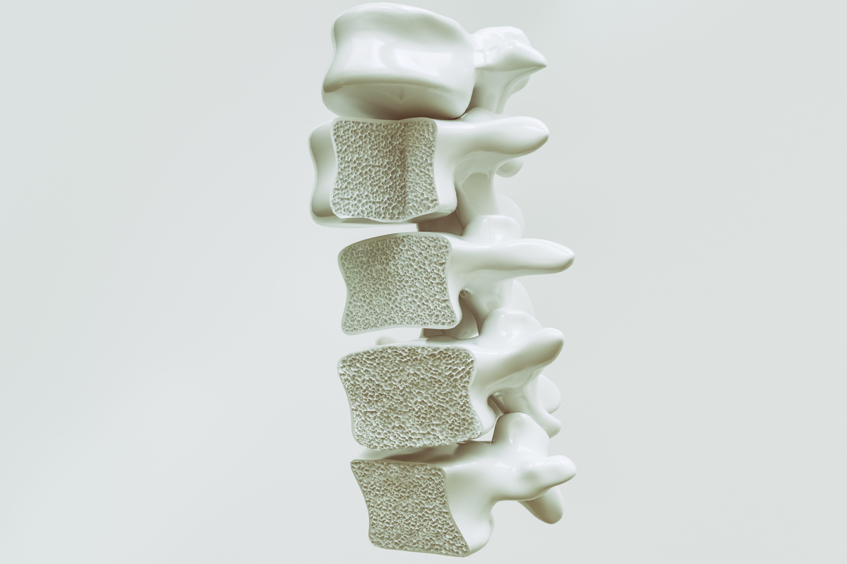 Osteoporosis on the spine - 3d rendering